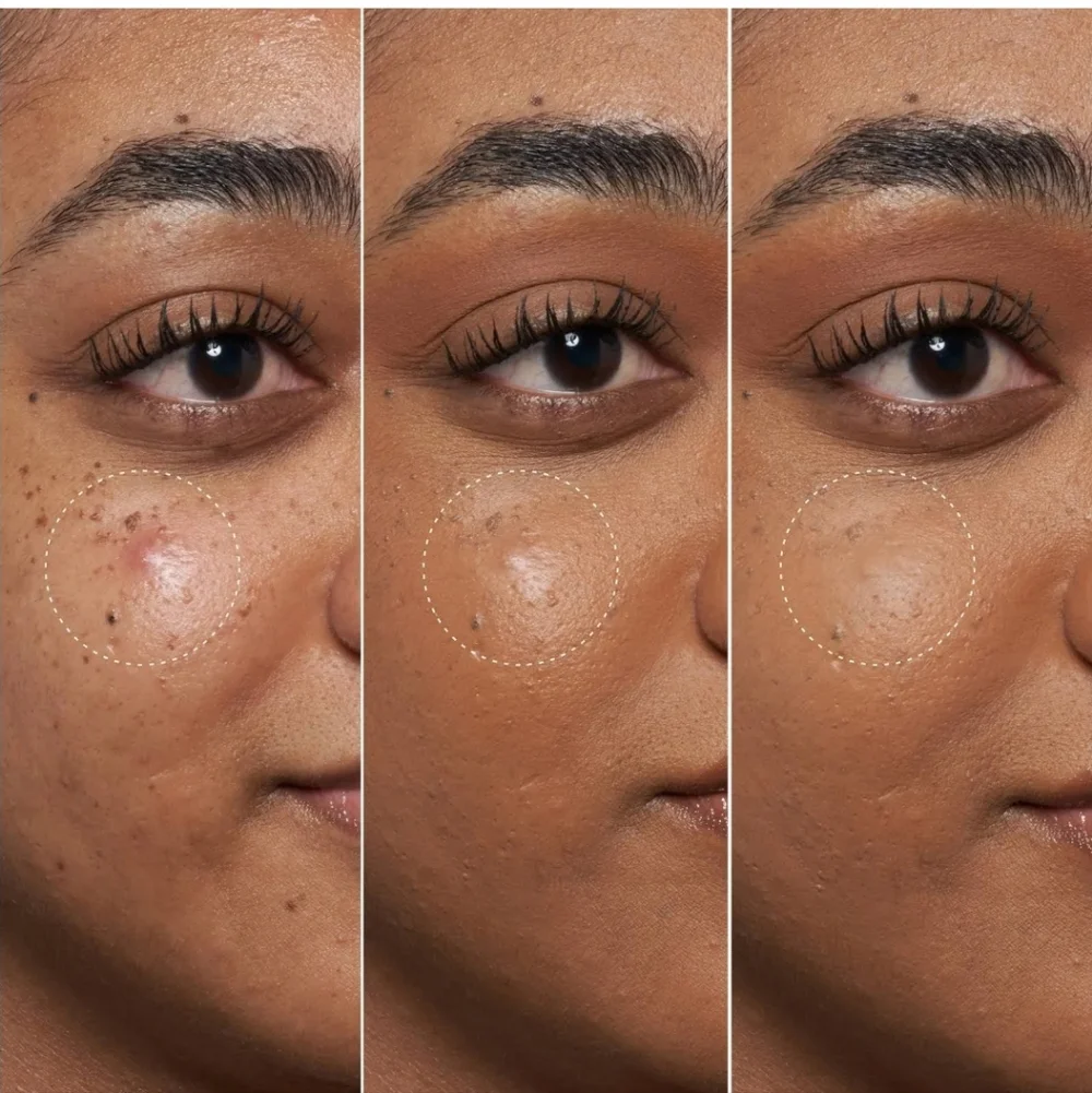 NIB Fenty Skin Blemish Defeat'r Spot Gel - Picture 5 of 7